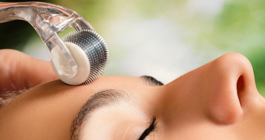 Dermaroller Treatment